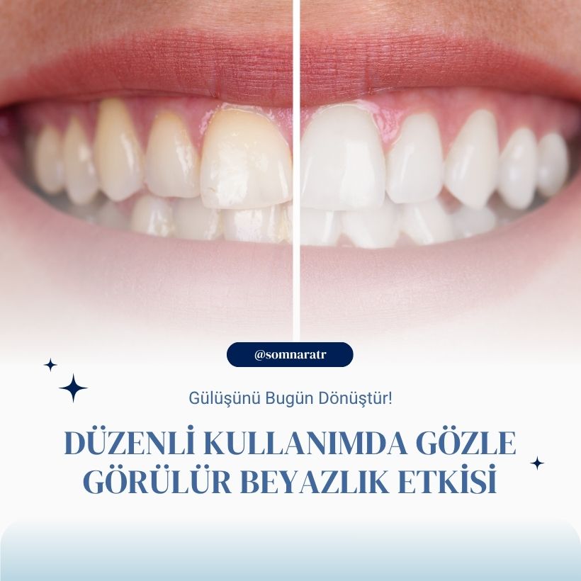 Somnara™ VitaBrush Pro