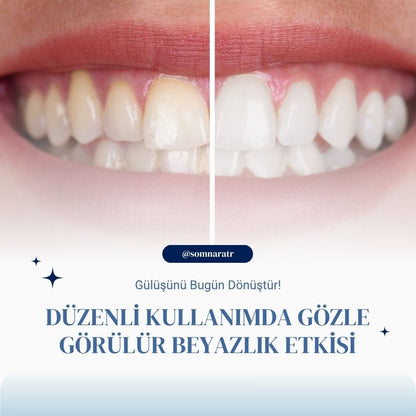 Somnara™ VitaBrush Pro