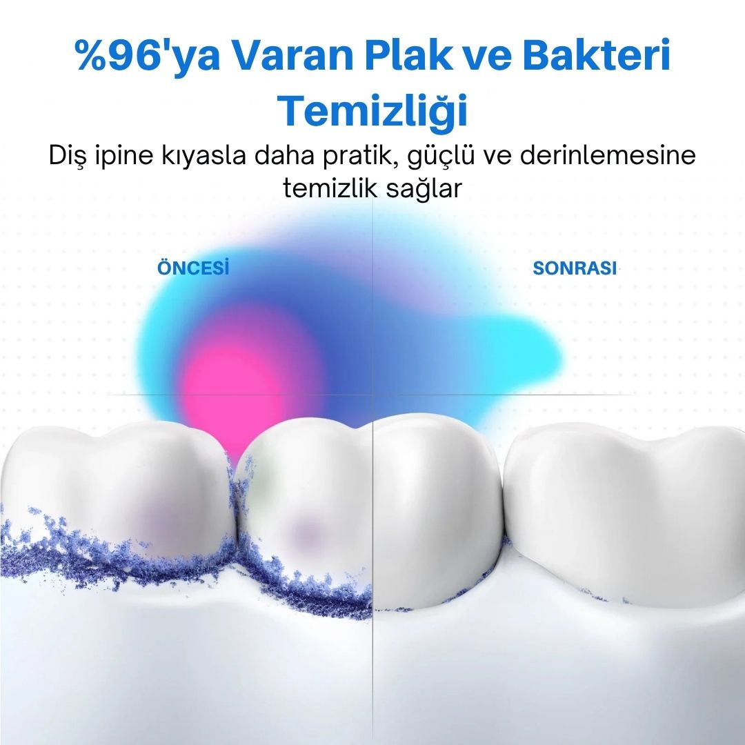 Somnara™ Lumin - Profesyonel Ağız Bakım Duşu